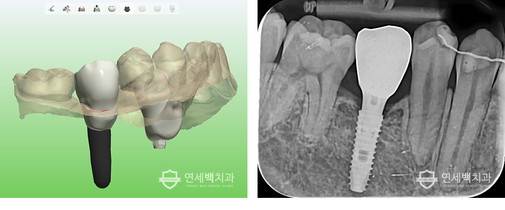 xray.jpg
