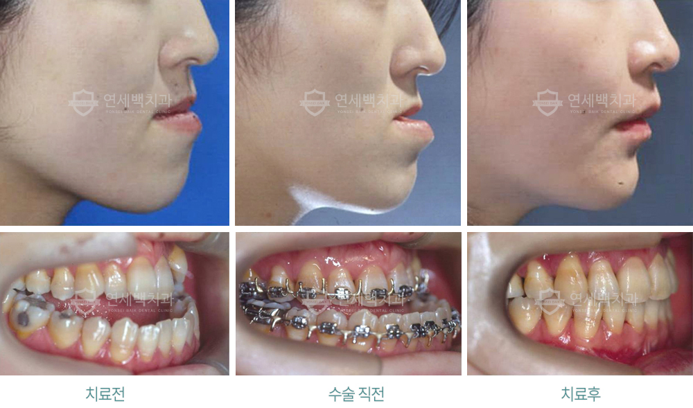 악교정.jpg