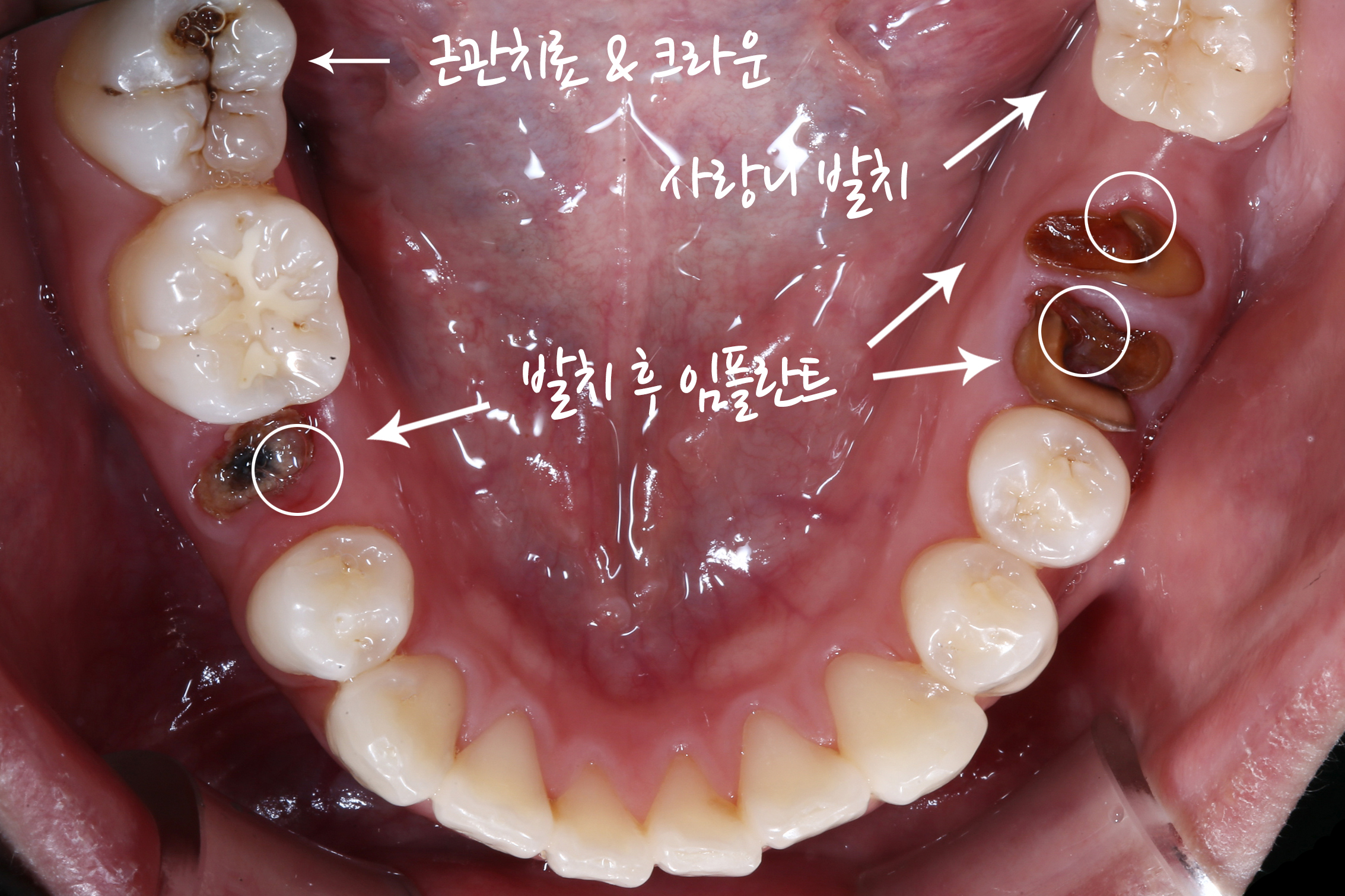 치과임상사진