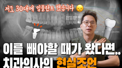 치아를 빼야된다고요? | 발치로 인한 상실감 | 치과의사의 임플란스 심은 썰
