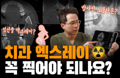 치과 엑스레이, 꼭 찍어야 되나요? | 치과 방사선 사진, 안전한가요?