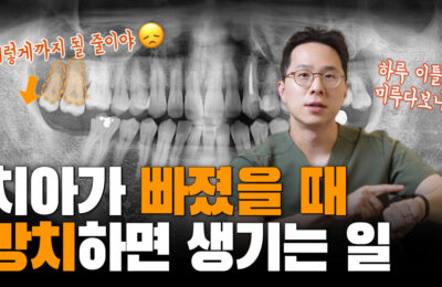 빠진 치아 방치하면 큰일나요 | 치아가 내려와서 임플란트할 공간이 없데요 | 대합치 정출 시 치료 방법