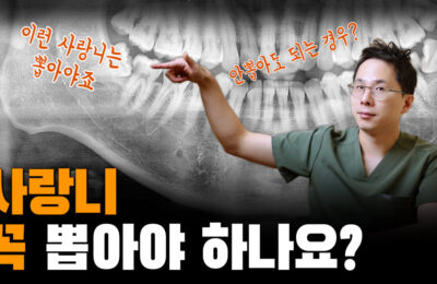 사랑니 꼭 뽑아야 하나요? | 사랑니를 빼야되는 경우