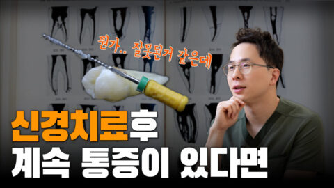 신경치료 후에도 여전히 아프다면? | 신경치료 많이 아픈가요?