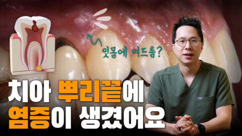 잇몸에 여드름 같은 것이 생겼어요 | 신경치료가 필요한 증상
