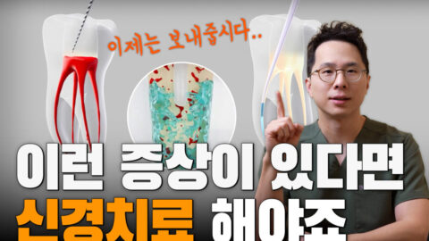 이런 증상이 있다면, 신경치료 꼭 해야합니다 | 신경치료가 필요한 증상
