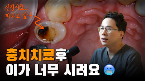 충치치료 후에 치아가 시린데 괜찮아질까요? |  치수복조술과 3차 상아질