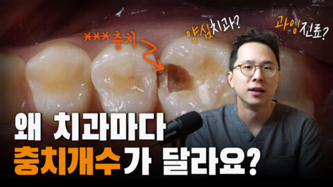 치과마다 충치 개수가 다른 이유  |  충치의 진단