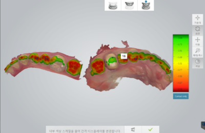 연세백치과에서 사용하고 있는 3D 스캐너
